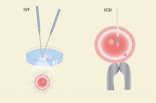 Fertility Clinic in Surat