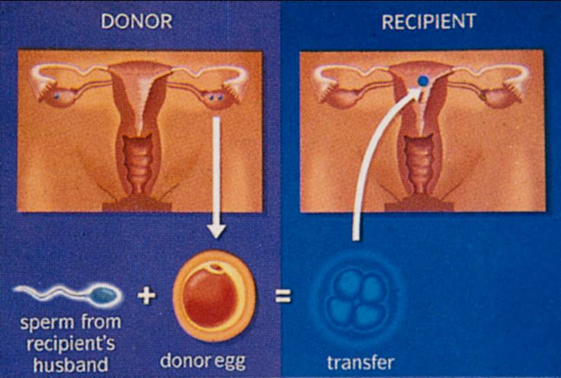 sperm donation in surat 